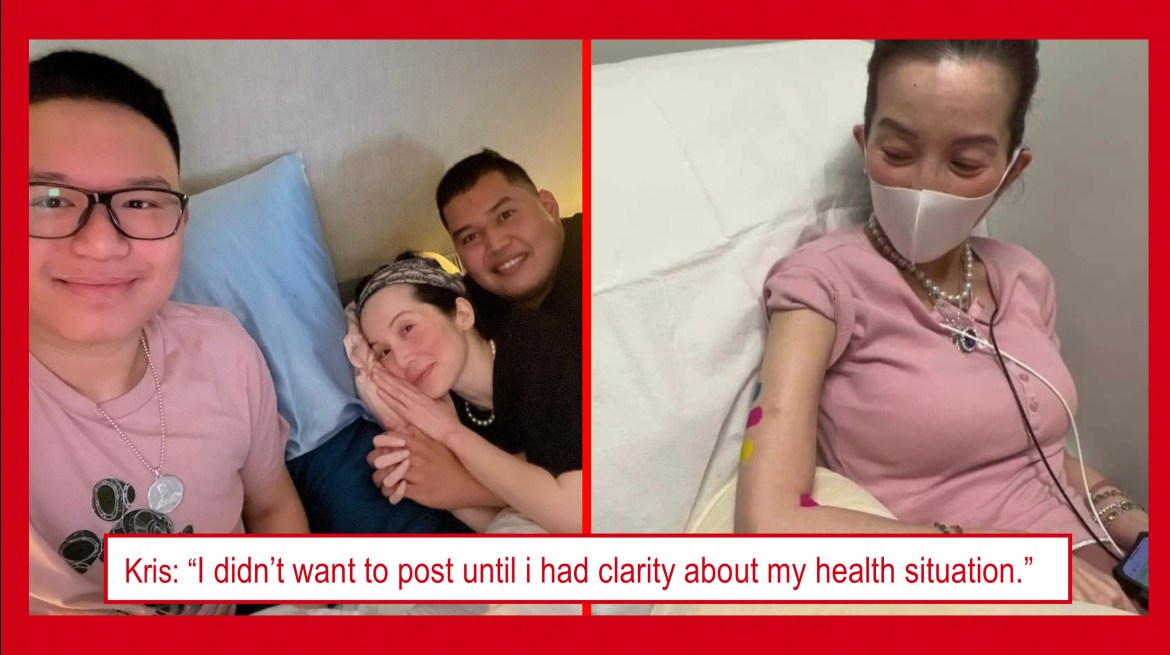 Kris Aquino, posibleng makalbo dahil sa pagpapagamot: “Dedma muna sa vanity.”