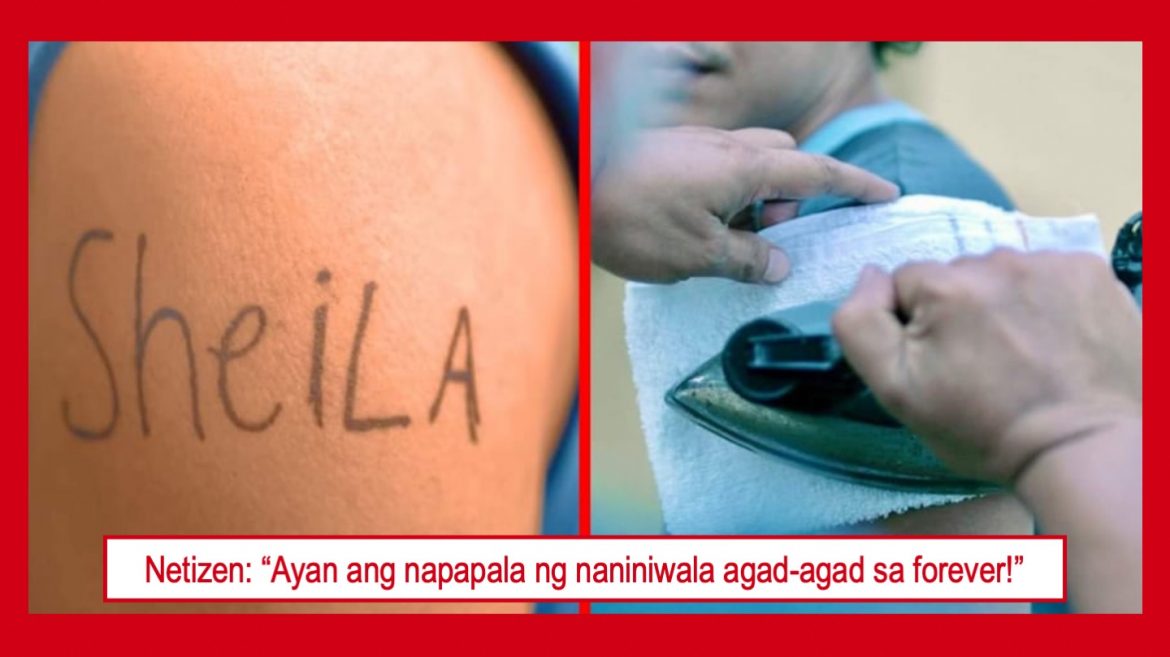 Tattoo ng pangalan ng ex sa braso ng isang lalaki, ipinabura sa pamamagitan ng plantsa